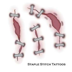  Tattoo Staple Stitch Fix (Case of 1): Home & Kitchen
