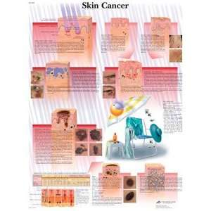 Skin Cancer 20 x 26 in.   Paper version  Industrial 