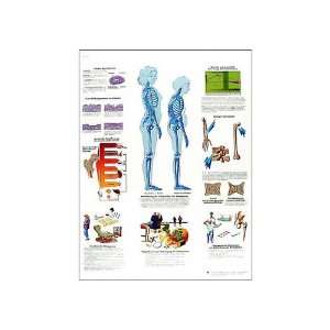   Paper Osteoporosis Anatomical Chart (Osteoporosis Anatomical Chart